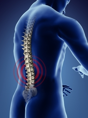 Sciatica Image